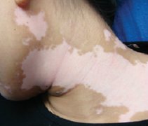 �ɶ���ʳ�ĵ������ڰ��综�ߵ���Ҫ��