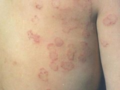 �ɶ����ƻ���Ѣ�ķ����Ƕ��٣�