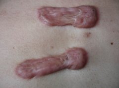 �ɶ��а̺�����ʳ����Ҫע��Щʲô��