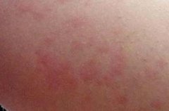 ����ʪ���Ԥ���ؼ���ʲô��