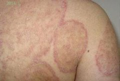 ��Ѣ�᲻�ᴫȾ��