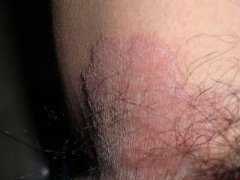 ��Ѣ������Ҫ������ʳ��