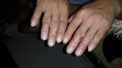 �ɶ���������Ѣ��Ƥ����ҽԺ