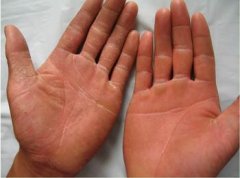 ����Ѣ������ЩΣ����