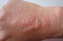 Ѱ��������Щ֢״����ֵ�����ǹ�ע��