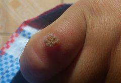 Ѱ�����������Щ�ٴ�����