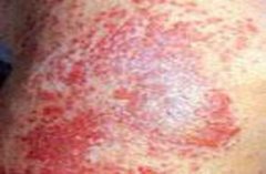 �ɶ�֬����Ƥ�����Ƶ�ҽԺ