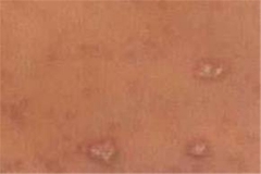 �ɶ�ʲôҽԺ��Ƥ�׺�