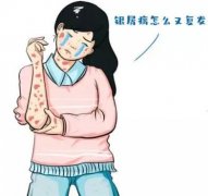 ��ͯ��ţƤѢ��ԭ������Щ