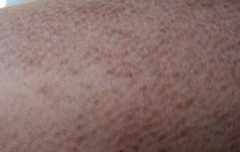 ���۲��ճ�����ע����Щ