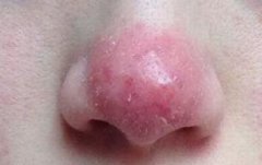 �ɶ������ҽԺ�ļҺ�