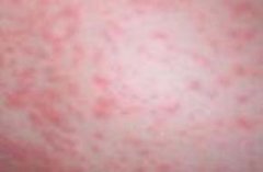 �ɶ��ļҿ�Ƥ�׵�ҽԺ��