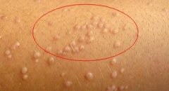 ��ƽ��ȥ�ɶ��ļ�ҽԺ��