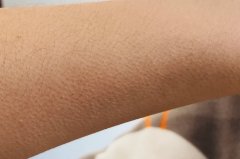 �ɶ��ĸ�ҽԺ��Ƥ��������