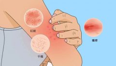 �ɶ���רҵƤ������ҽԺ