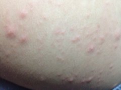 �ɶ�����֬����Ƥ�׵�ҽԺ