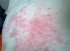 �ɶ�����Ƥ��ҽԺ�ļҺ�